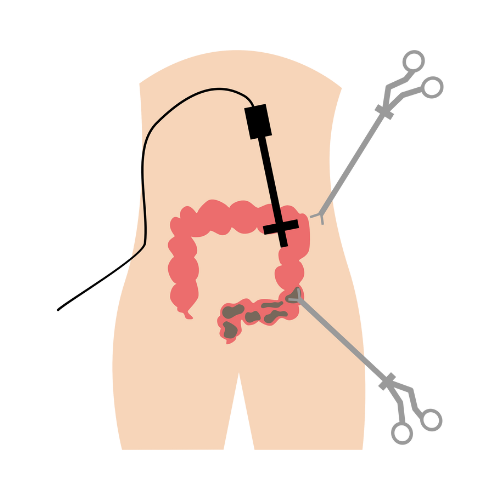 Laparoscopy & Robotic Icon